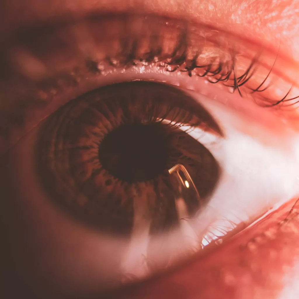 red eyes